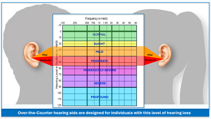 Audiogram Diagram