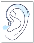 Receiver in Canal (RIC) Hearing Aid