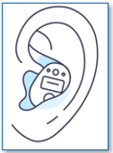 In-the-Ear (ITE) Hearing Aid