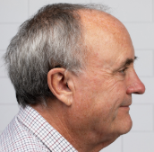 Product model Beam in Use